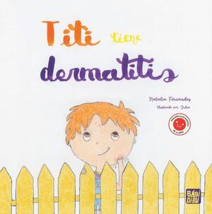 TITI TIENE DERMATITIS