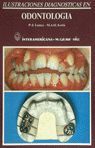 ILUSTRACIONES DIAGNÓSTICAS EN ODONTOLOGÍA