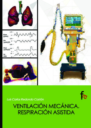 MANUAL DE VENTILACIÓN MECÁNICA